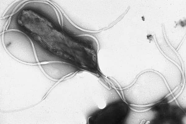 Immagine al microscopio del batterio Helicobacter pylori