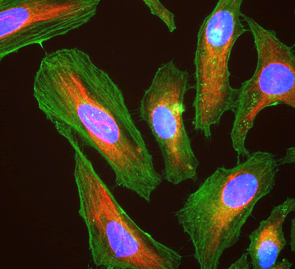 Cellule HeLa al microscopio colorate con anticorpi per actina, vimentina e DNA